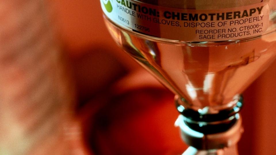 Chemotherapy spreads cancer, scientists confirm What Doctors Don't