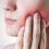 Gum disease could kickstart neck cancer